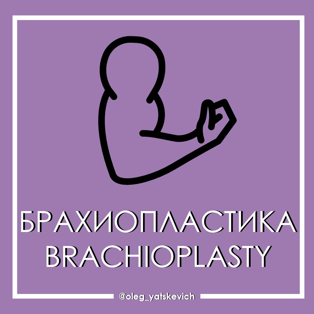 Брахиопластика