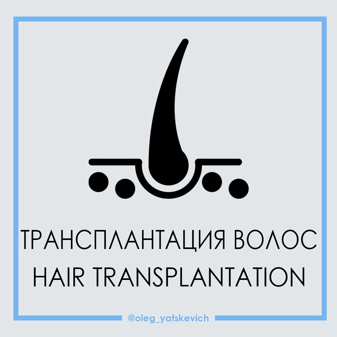 Трансплантация волос